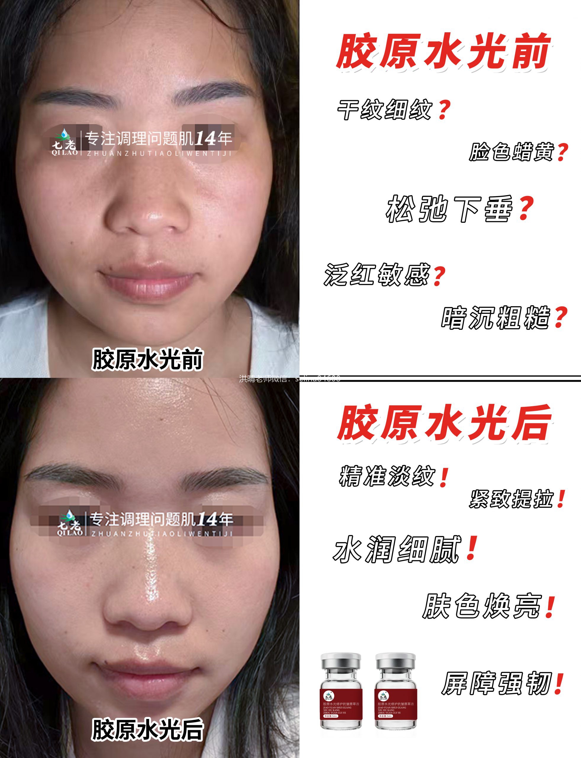 七老胶原水光修护抗皱原液