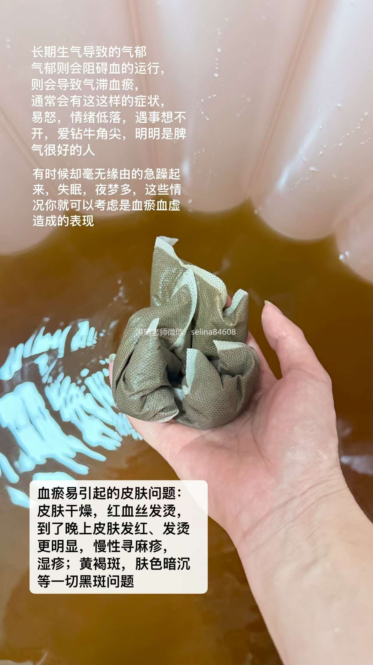七老内调养生→血府逐淤汤泡脚泡澡都适合