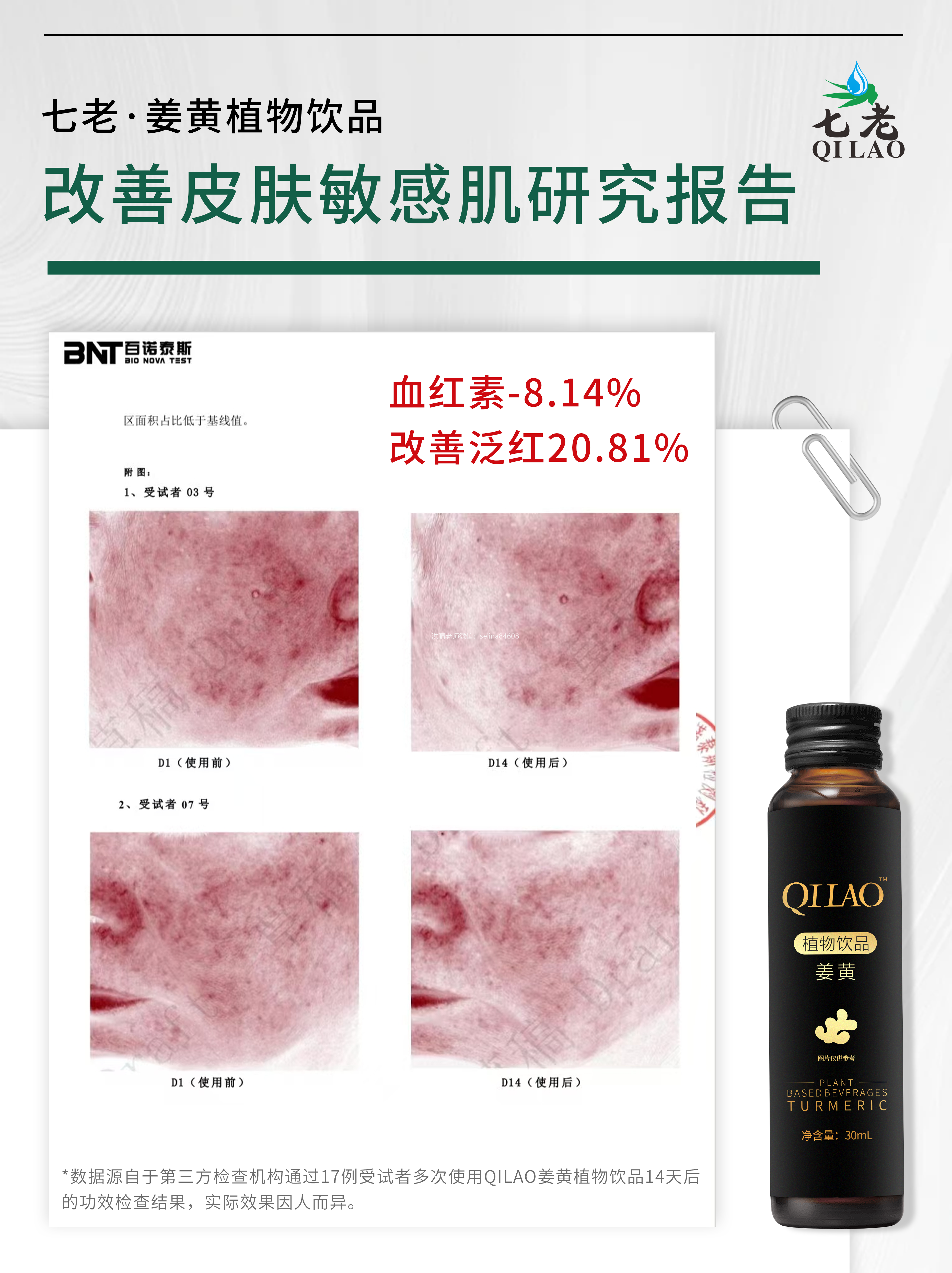 七老姜黄抗炎饮抗炎调理慢性炎症养肝护肝