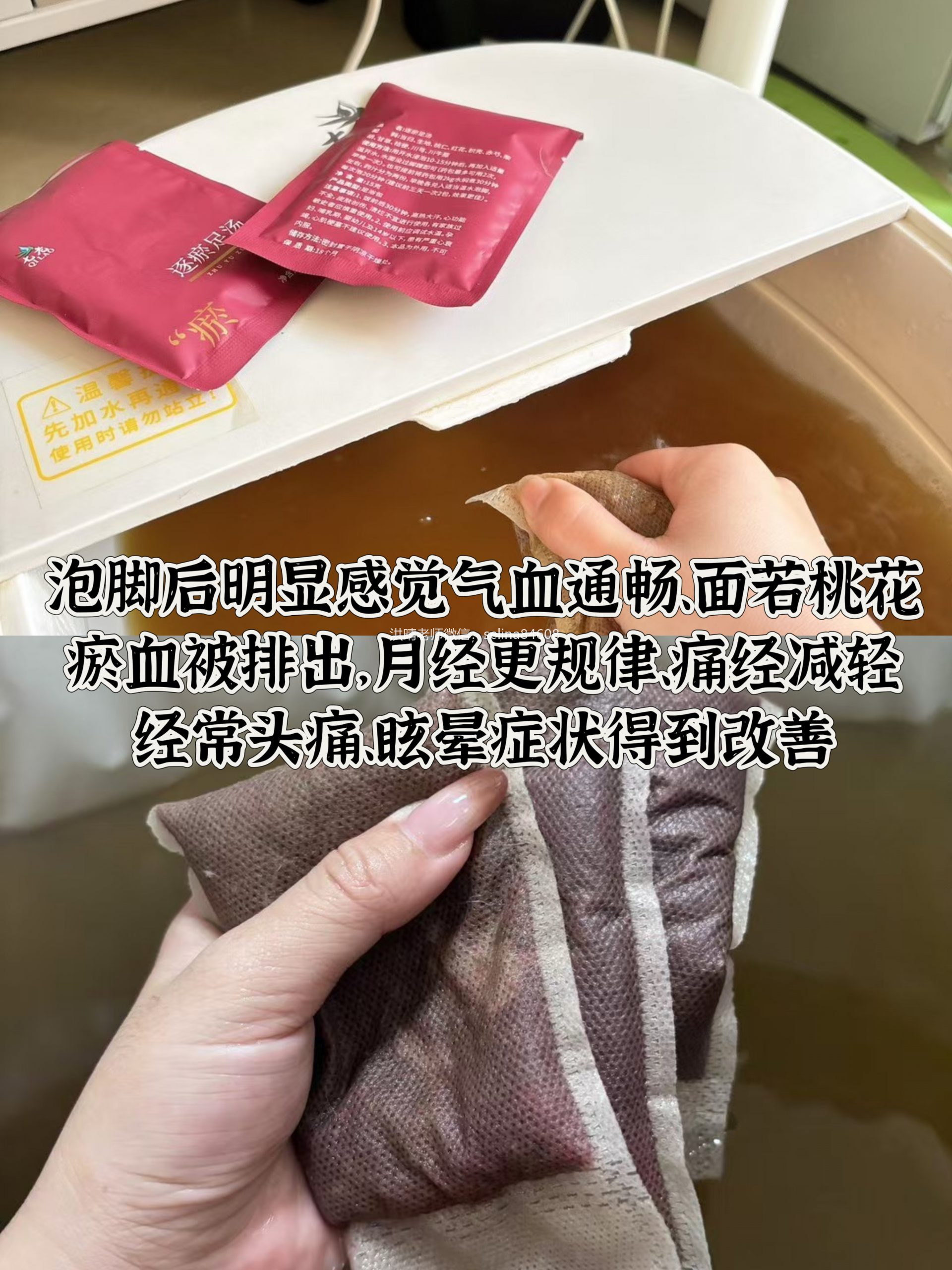 七老血府逐淤汤→通经络活血化瘀堵养气血