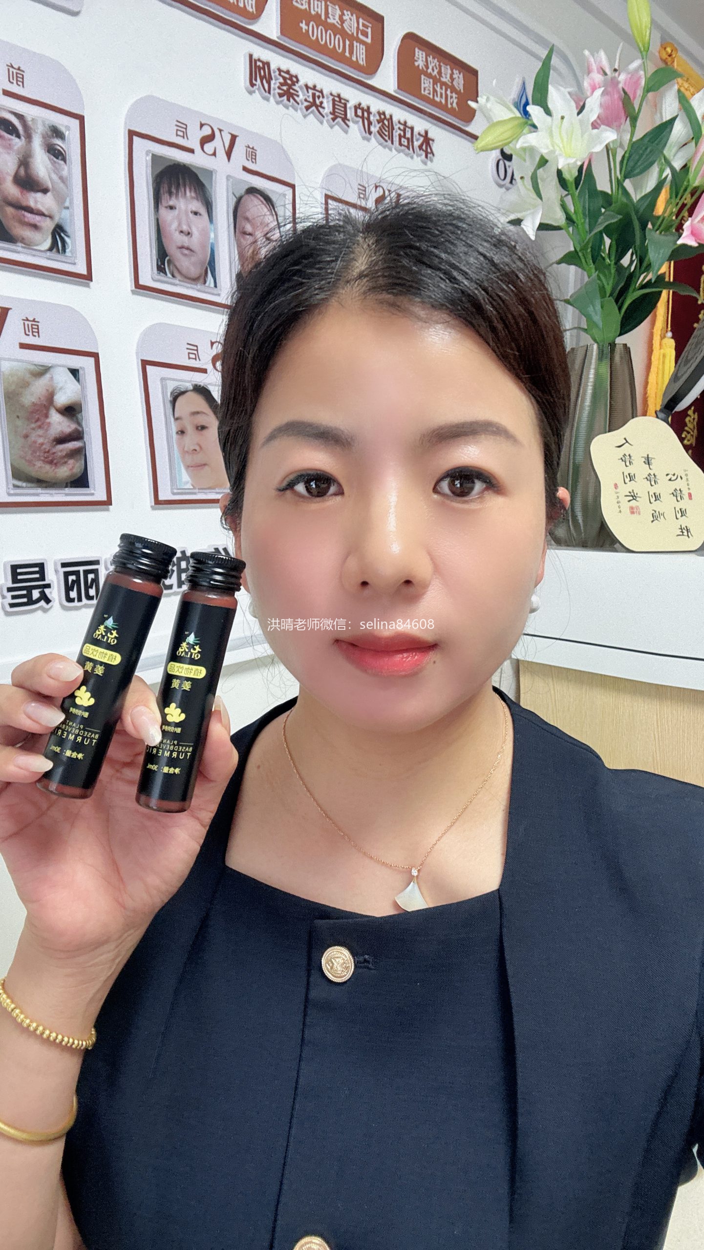 七老激素脸修护案例→全脸脖子红肿痒疹子爆皮