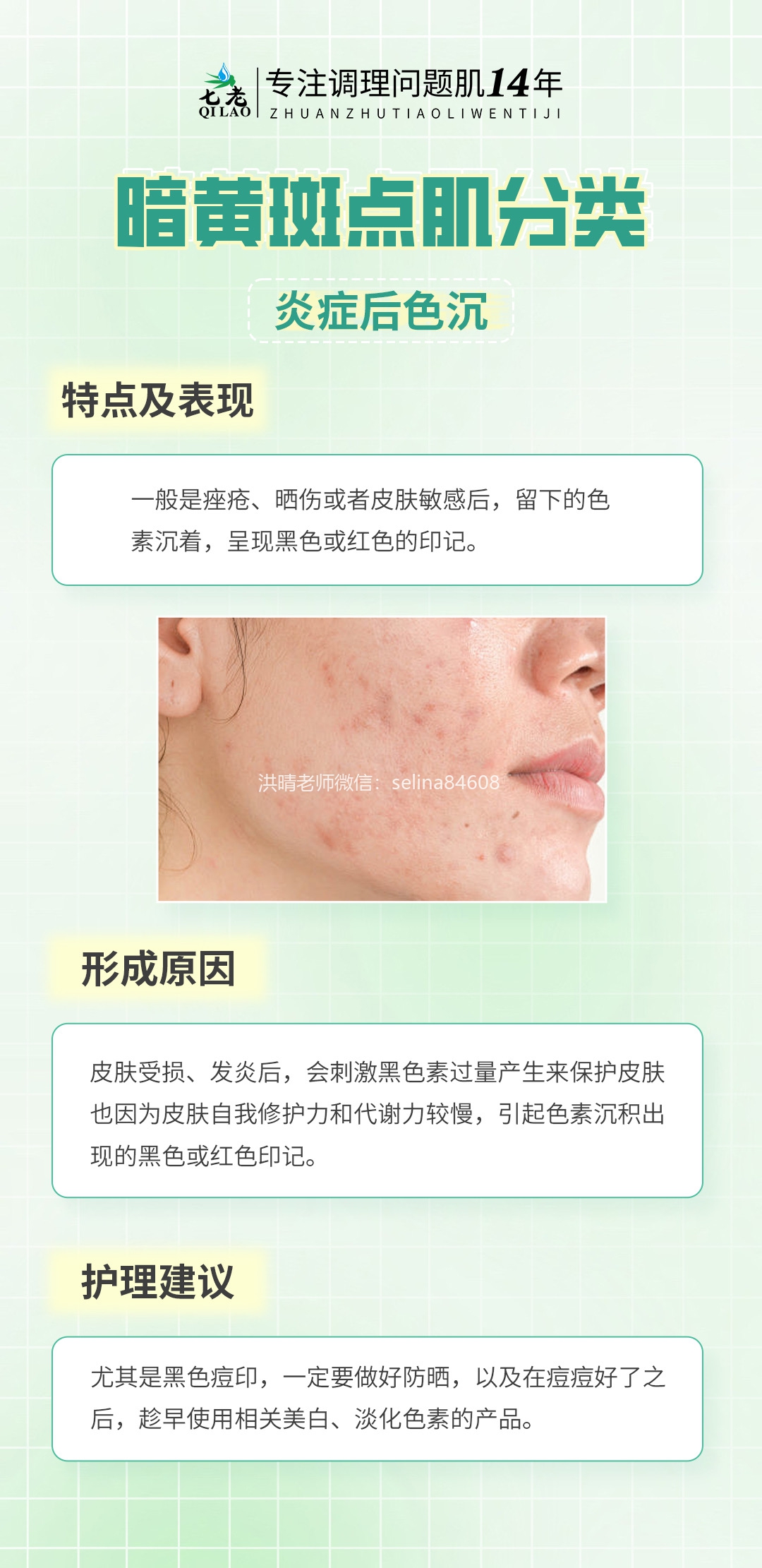 七老洪晴专业知识科普