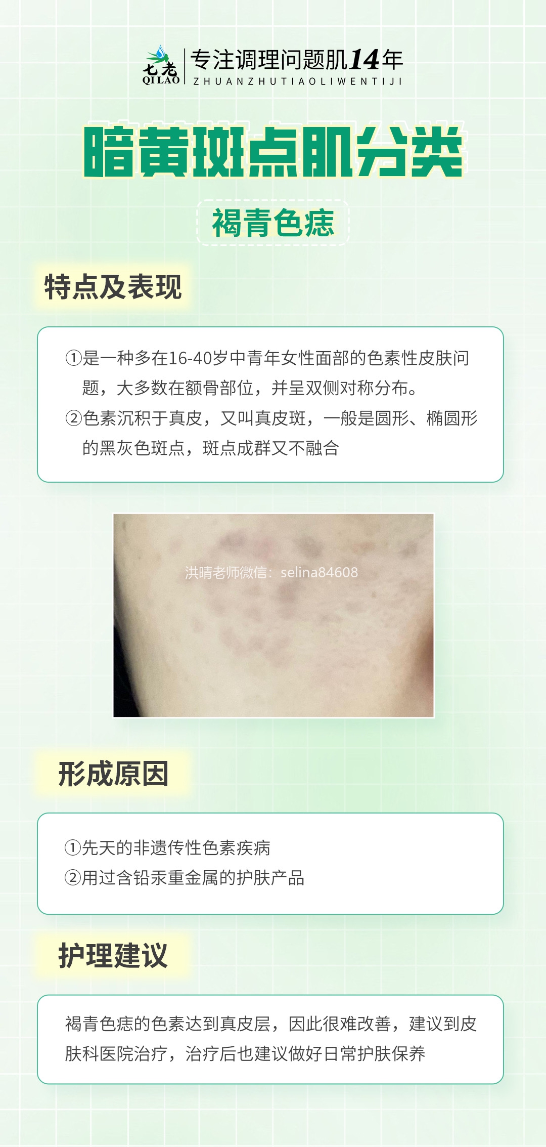 七老洪晴专业知识科普