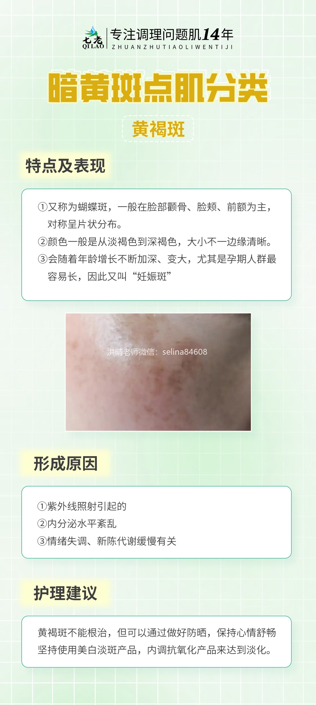 七老洪晴专业知识科普