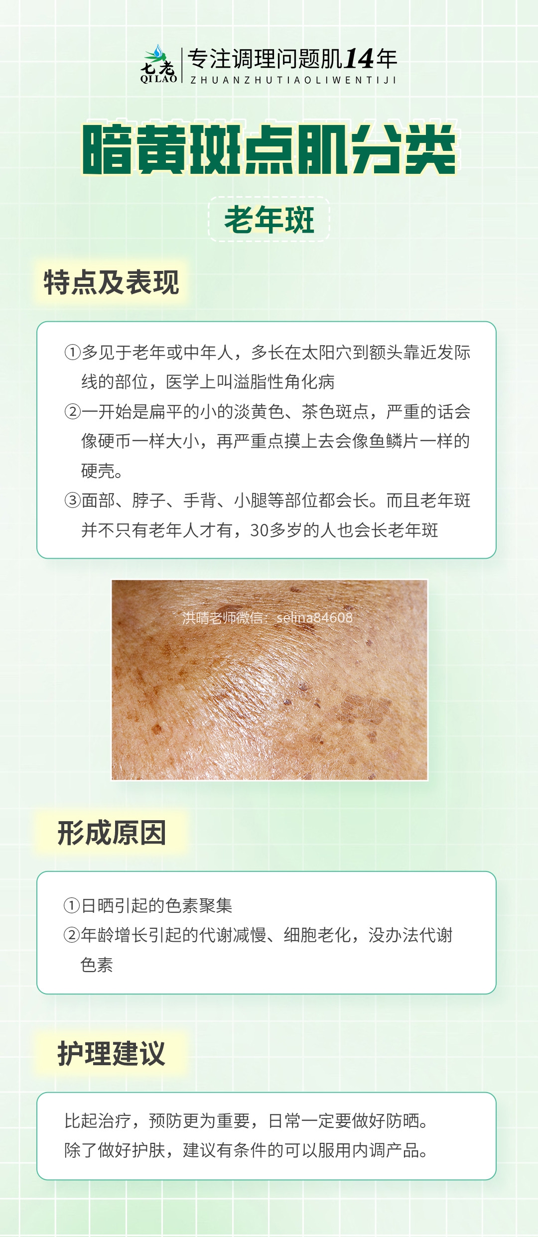 七老洪晴专业知识科普