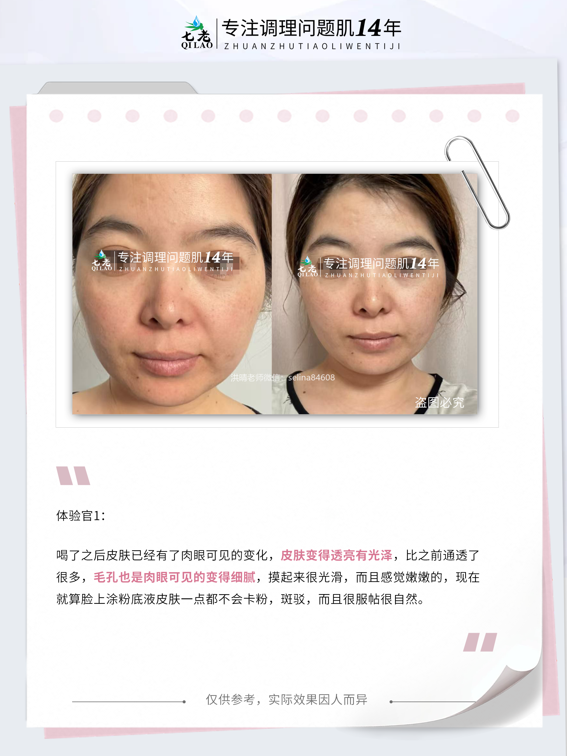 七老四重肽胶原蛋白补充胶原紧致抗衰