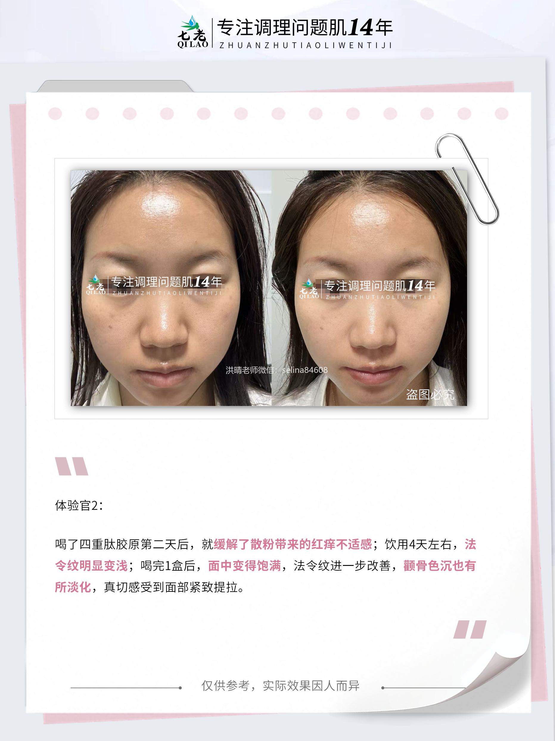 七老四重肽胶原蛋白补充胶原紧致抗衰