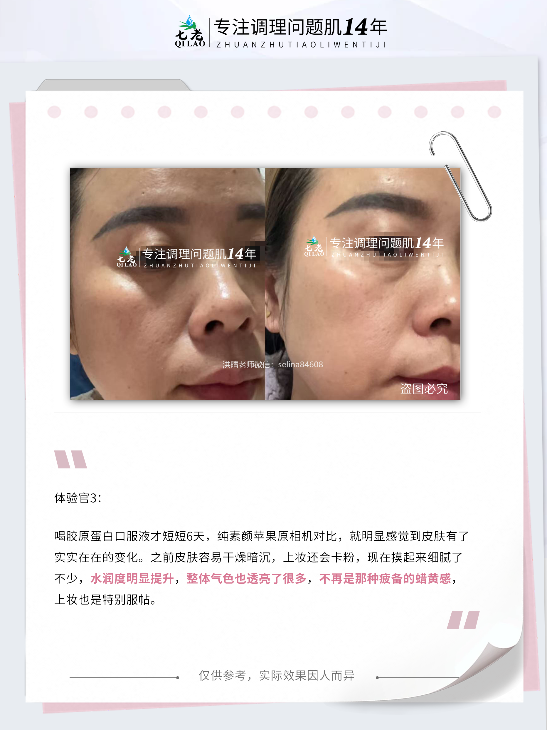 七老四重肽胶原蛋白补充胶原紧致抗衰