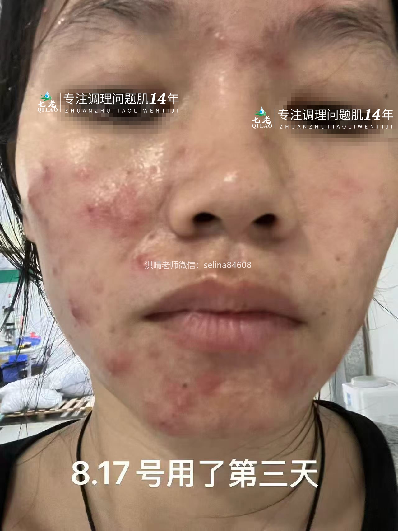 七老新品金线莲内测反馈