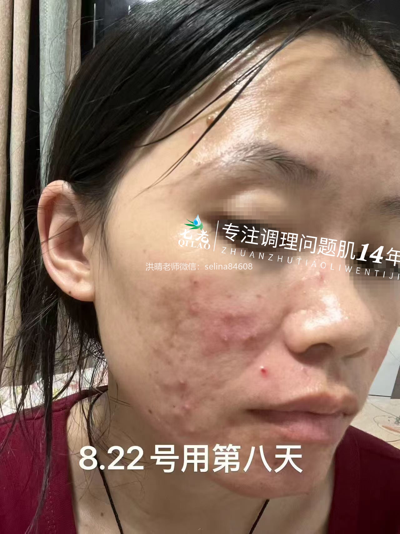 七老新品金线莲内测反馈