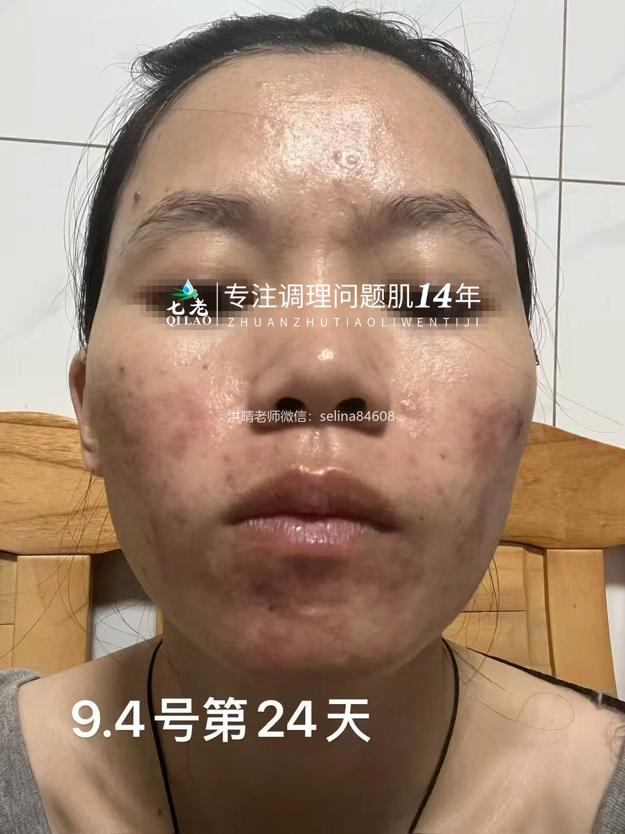七老新品金线莲内测反馈