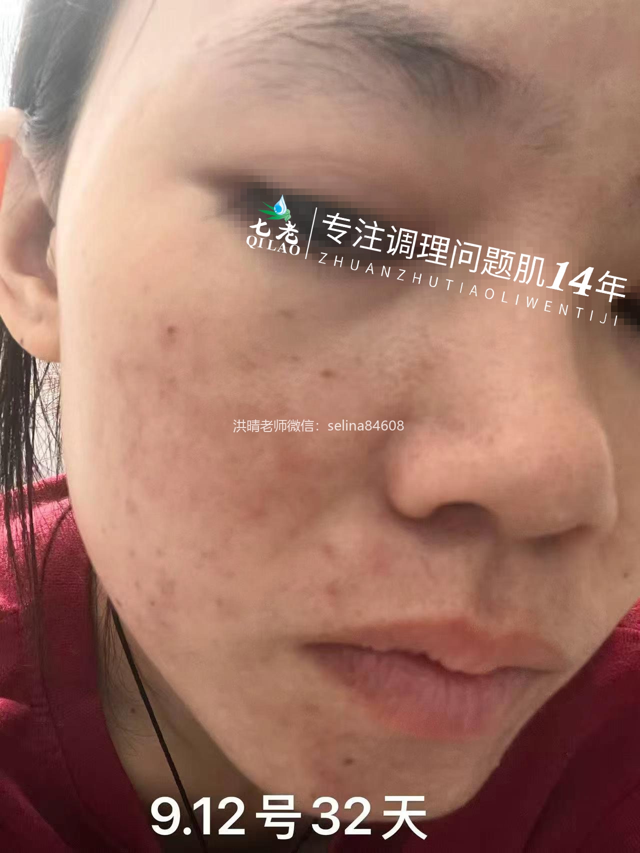 七老新品金线莲内测反馈