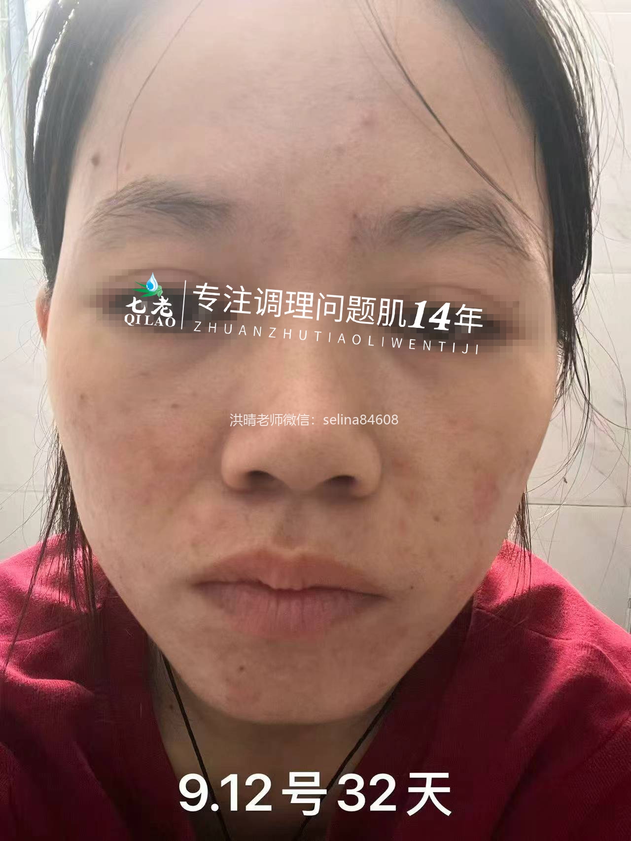 七老新品金线莲内测反馈