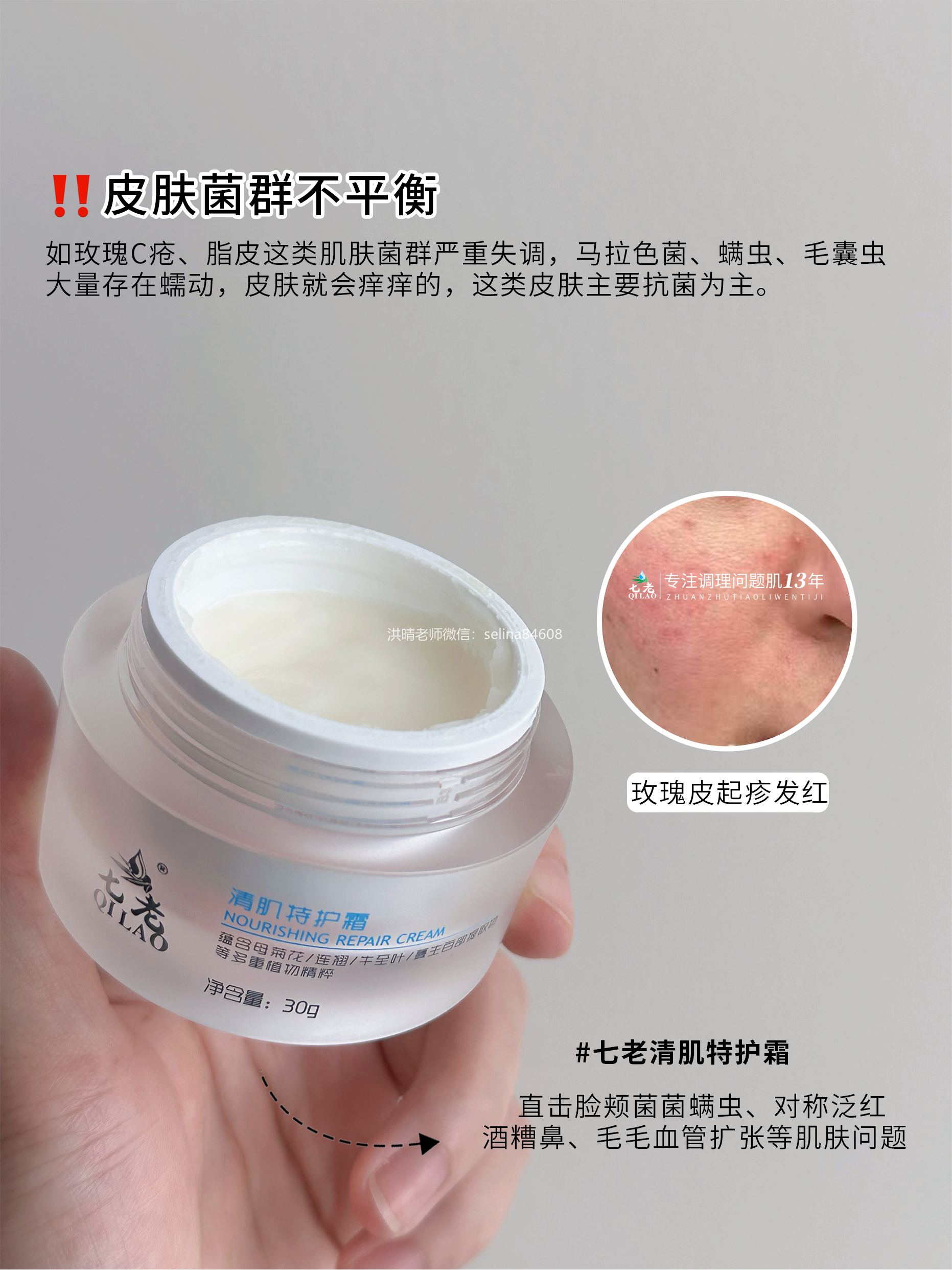 七老亚马逊清洁泥膜→玫瑰皮脂皮必备，周期护理深层清洁疏通毛孔