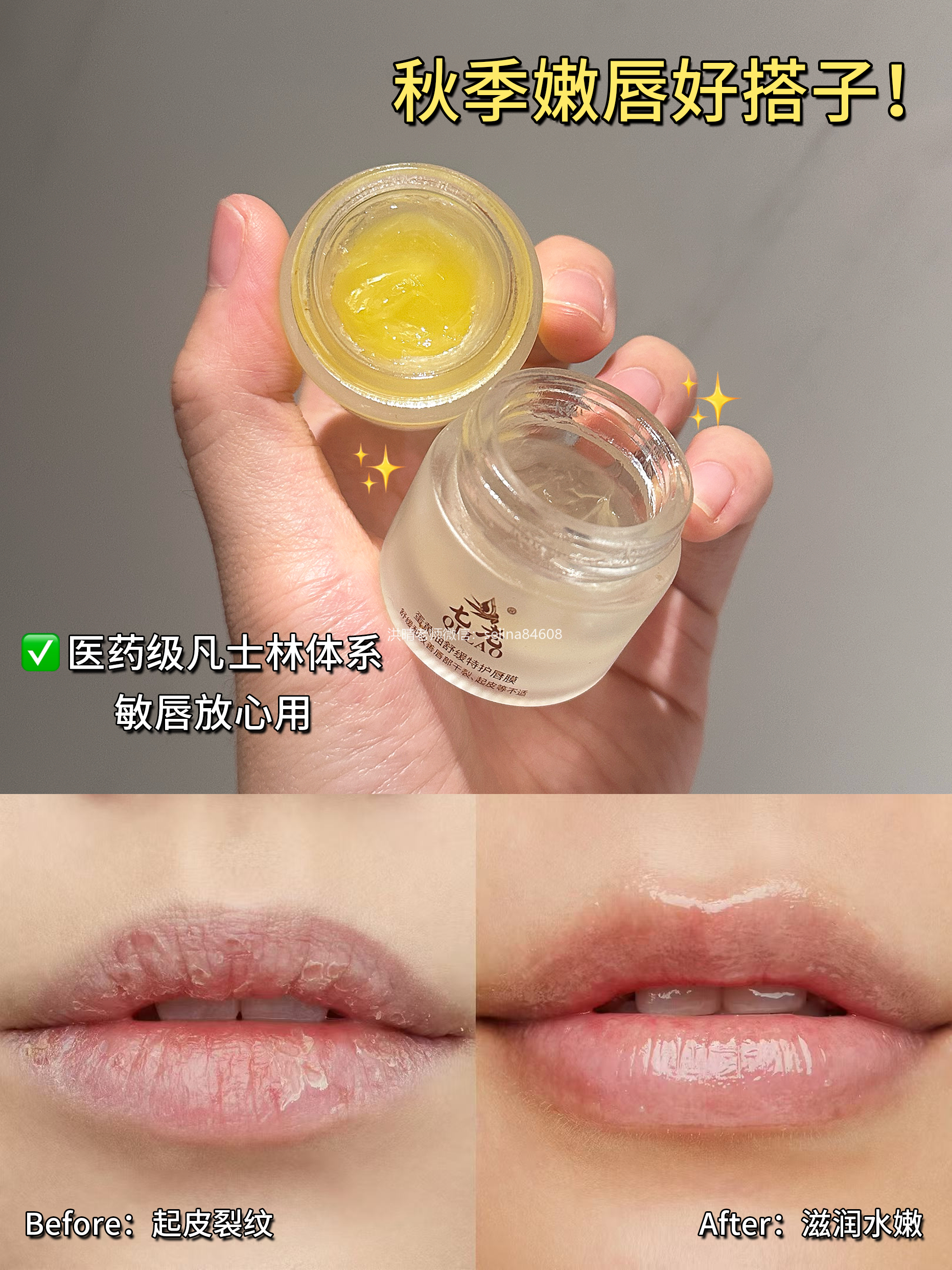 七老唇膜→秋冬天唇部修护滋润保湿刚需