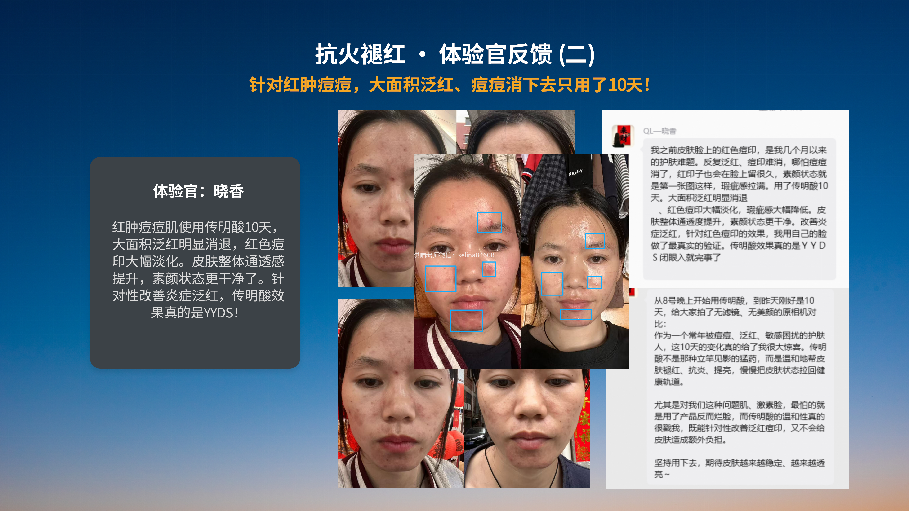 七老传明酸，红黑，暗沉，黑斑脸用它
