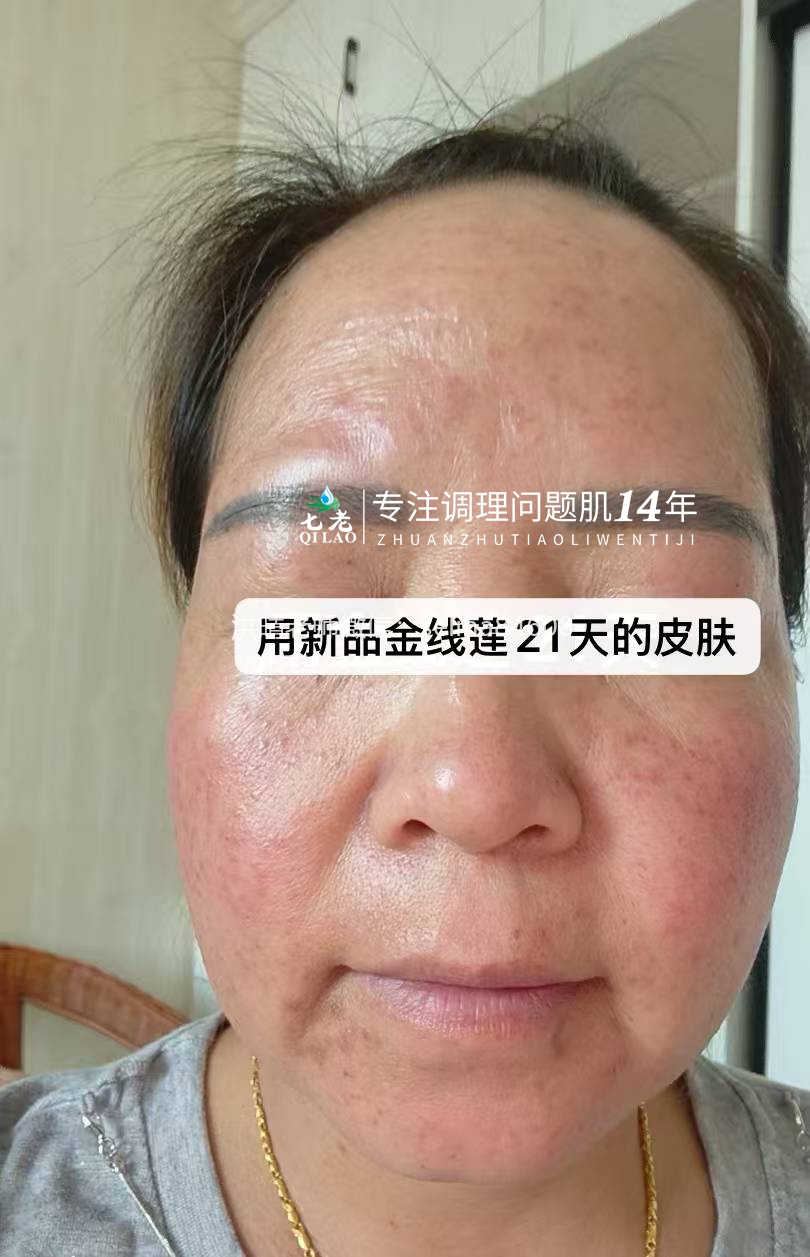 七老金线莲新品内测案例