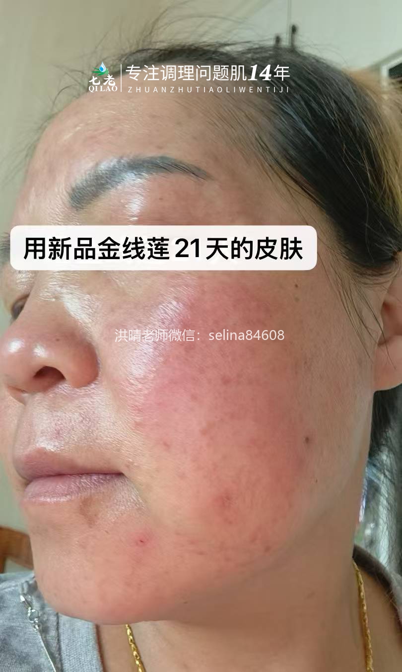 七老金线莲新品内测案例
