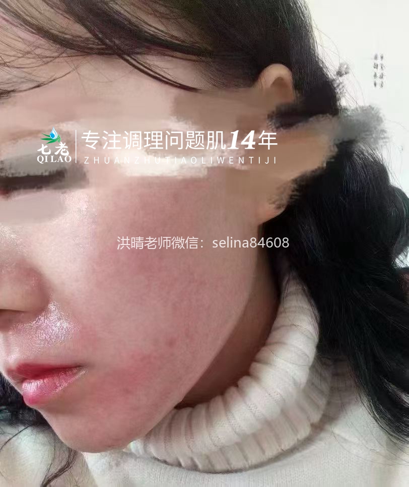 七老胶原水光→用过都会爱上