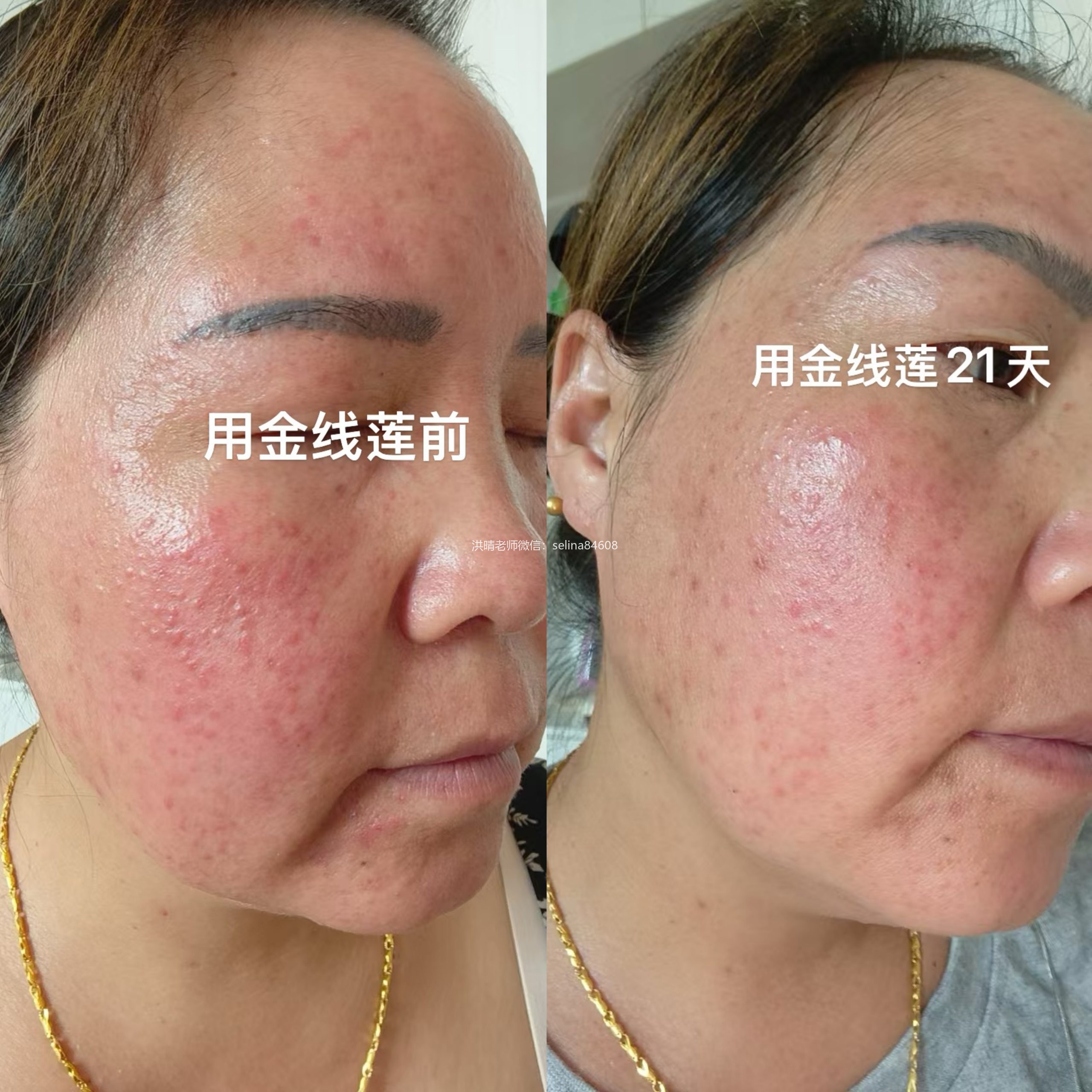 七老新品金线莲反馈