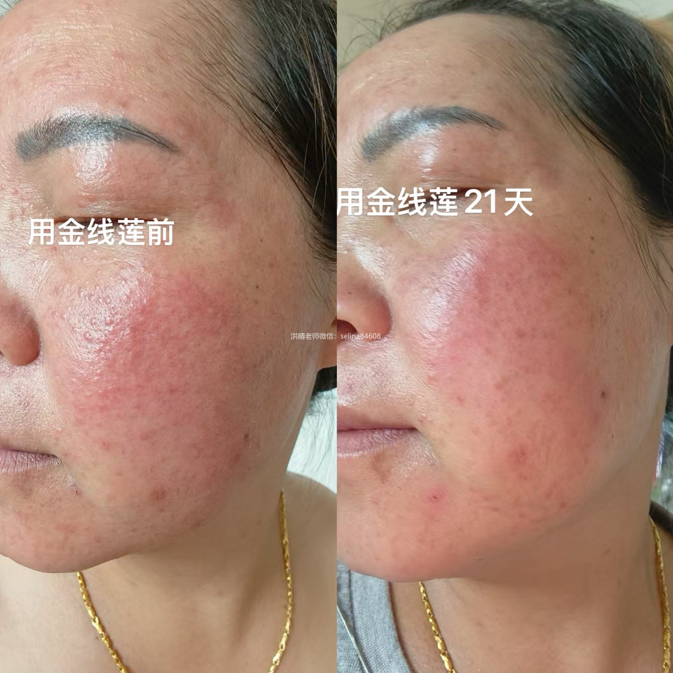 七老新品金线莲反馈