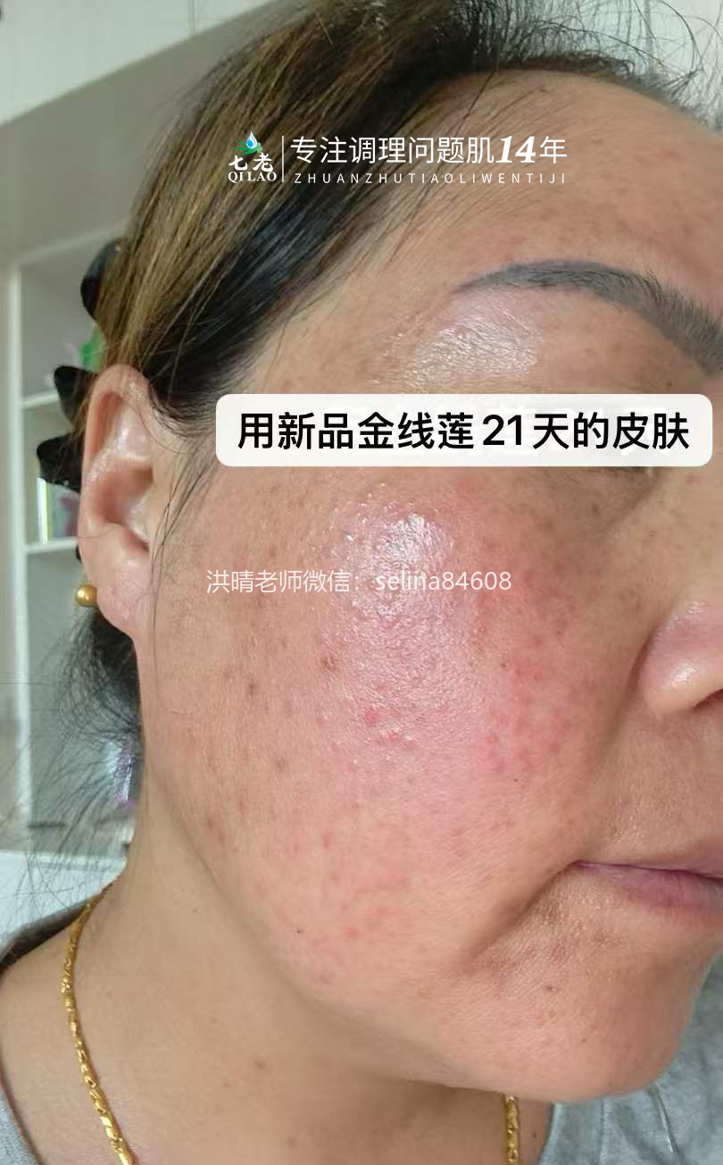 七老金线莲新品内测案例