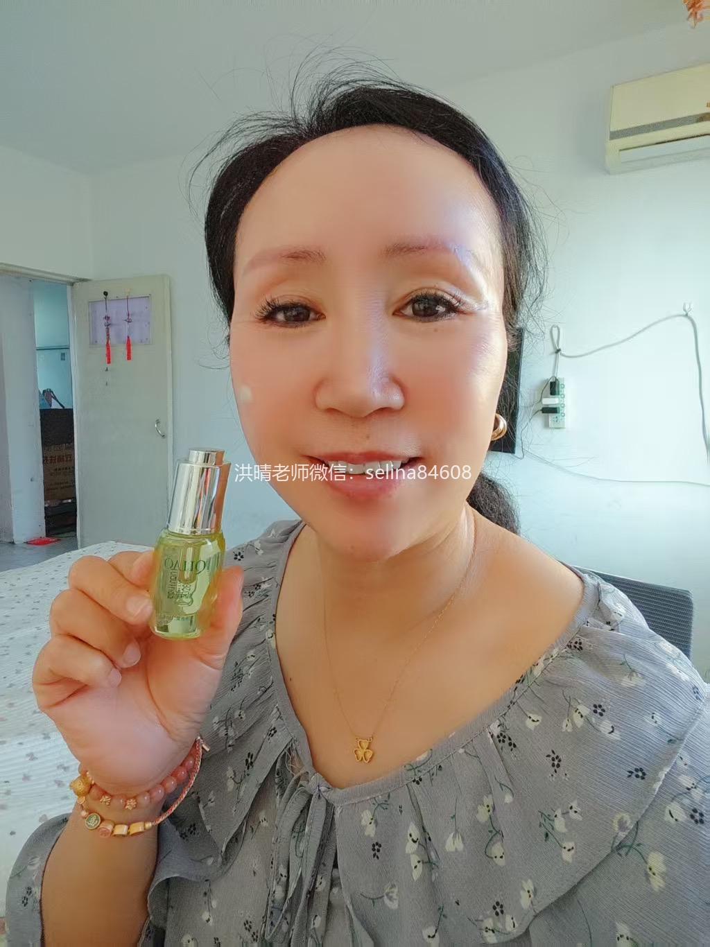 七老严重激素脸玫瑰痤疮修护案例