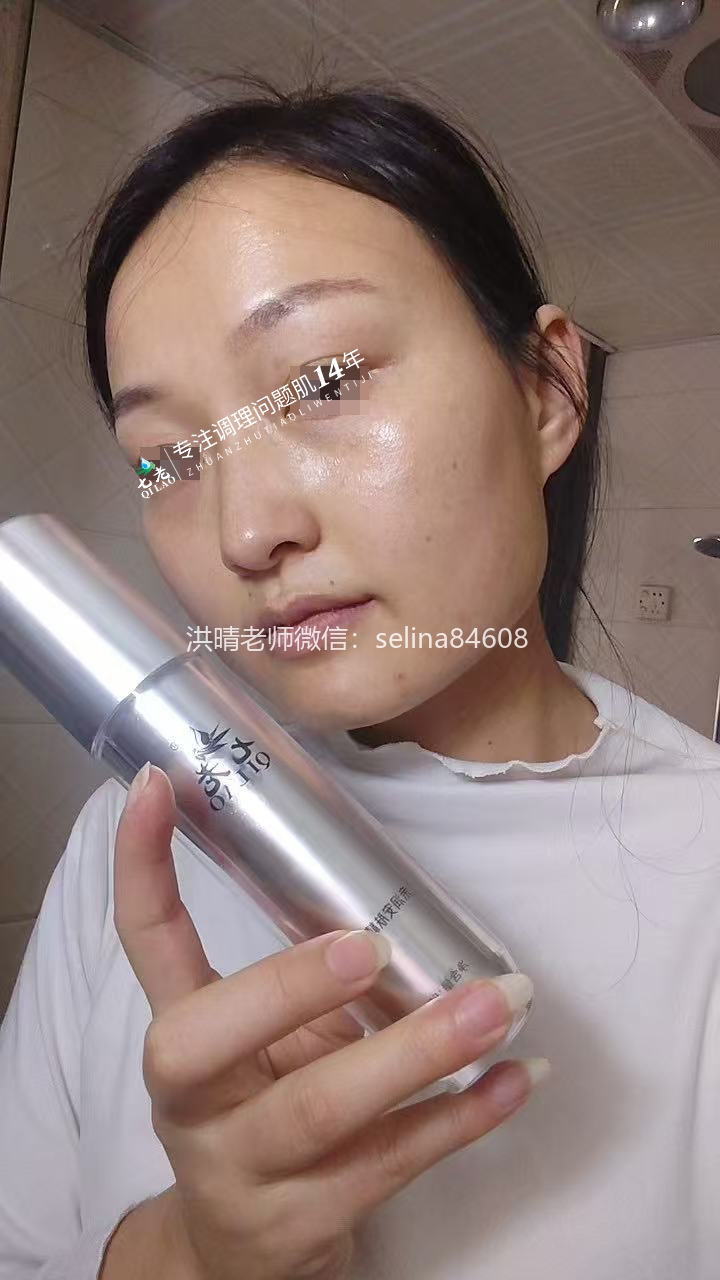 七老脂皮痘痘修护案例