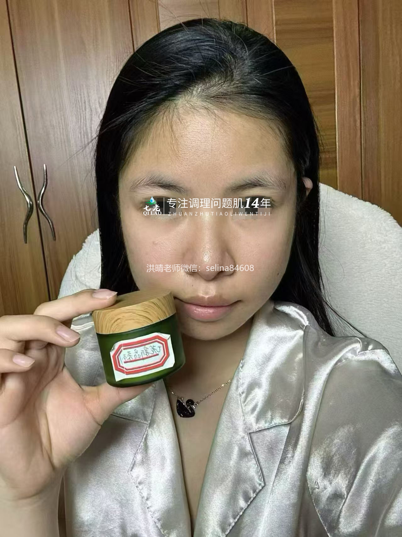 七老新品金线莲内测油敏疹子痘痘修护案例