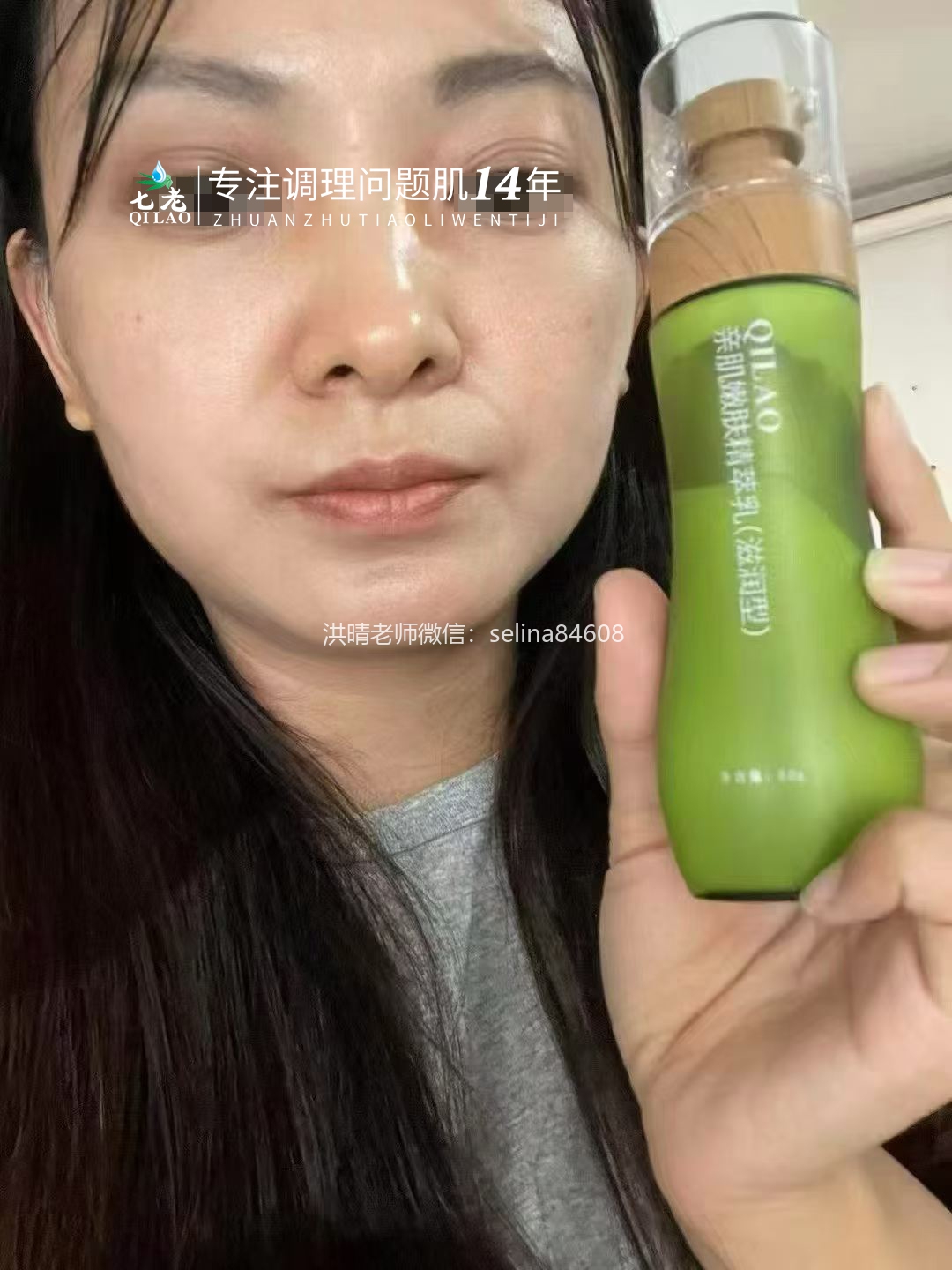 七老大红脸修护案例