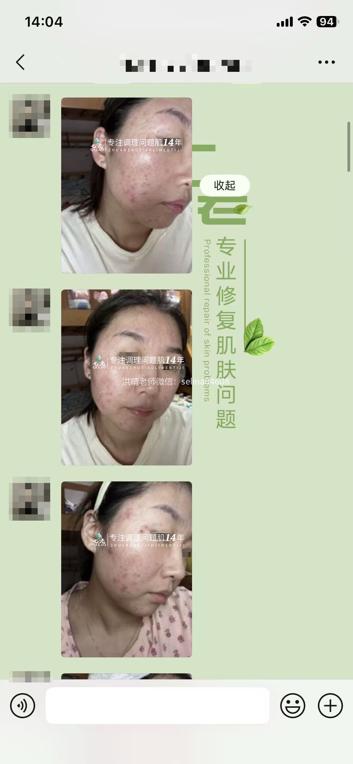 七老新品净孔祛痘系列内测反馈