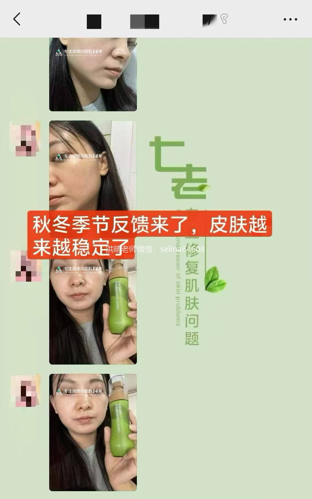 七老大红脸修护案例