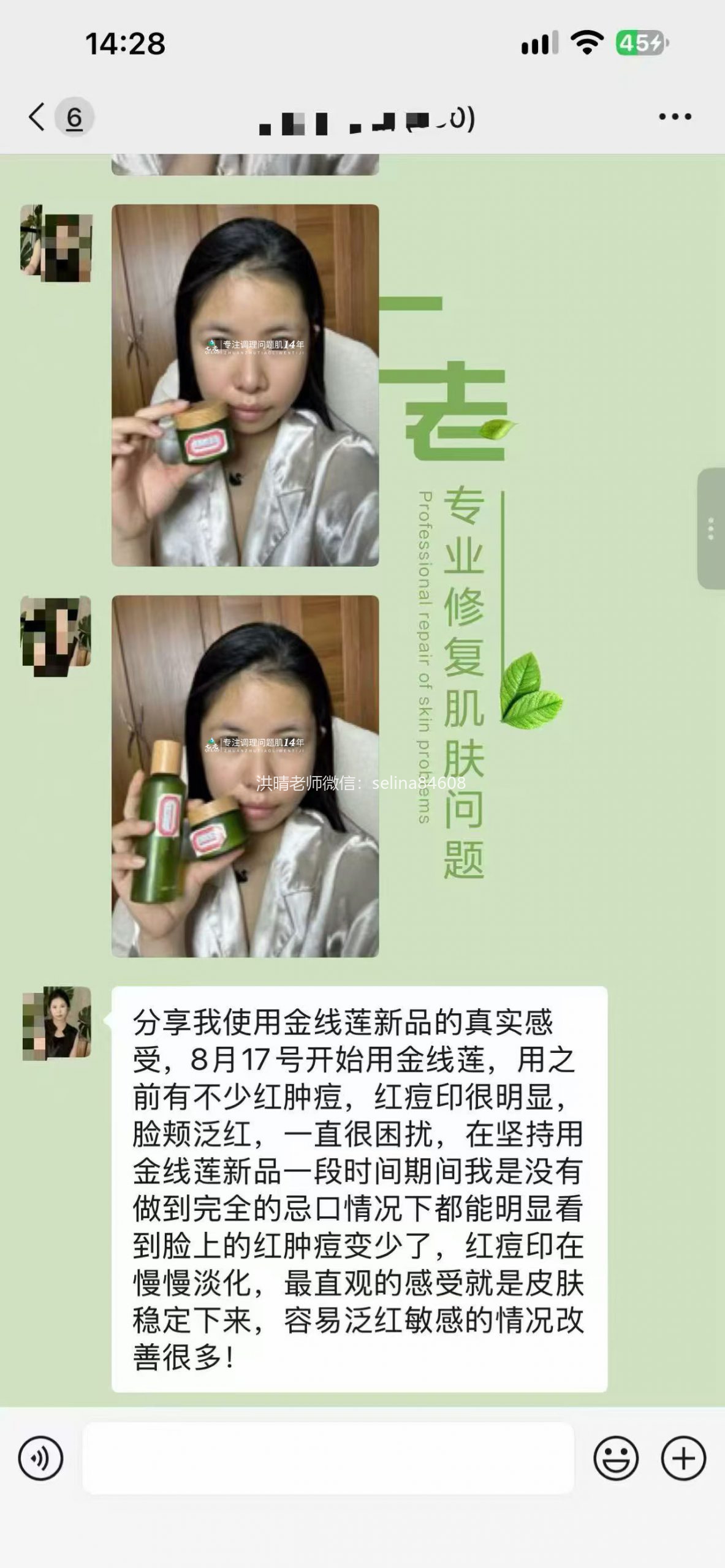 七老新品金线莲内测油敏疹子痘痘修护案例